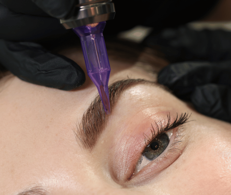 Eyebrow Transplants