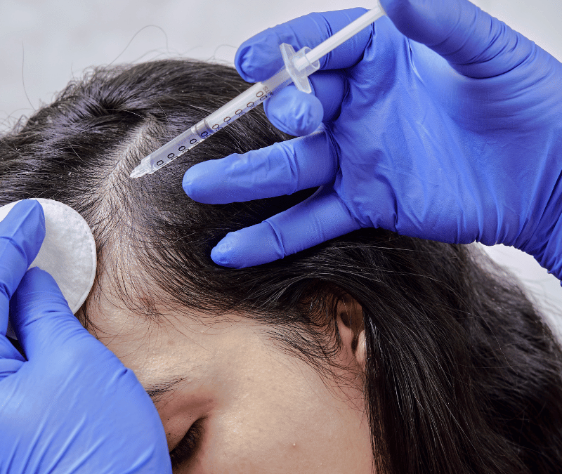 Female Hair Restoration