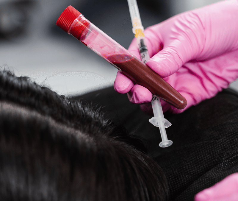 PRP (Platelet-Rich Plasma)